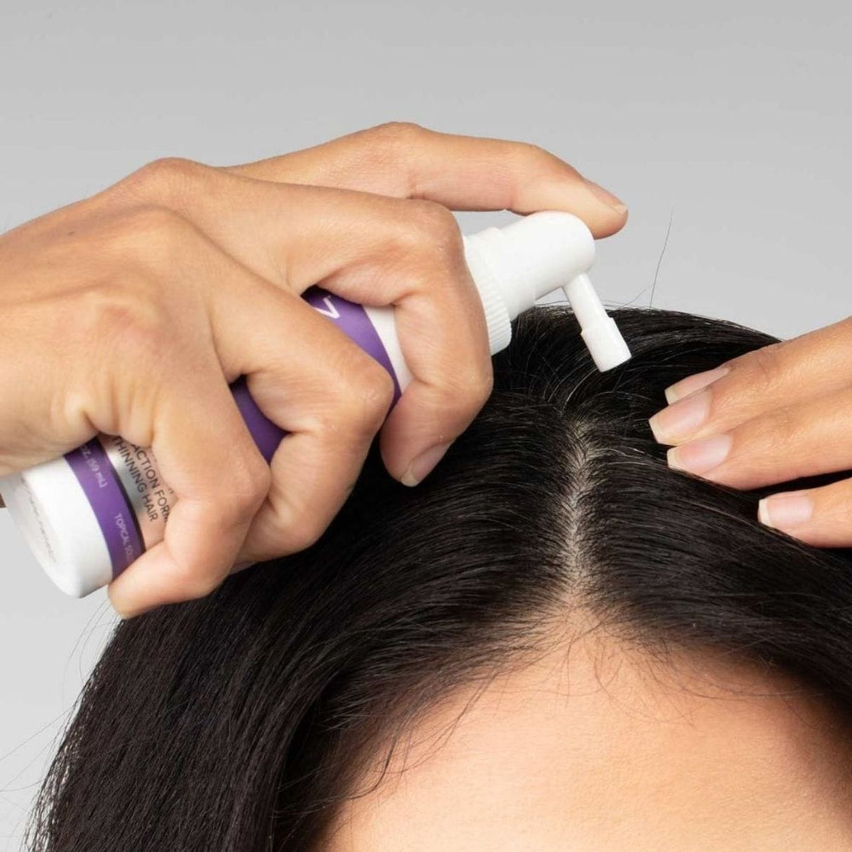 Foligain Triple Action Complete Formula For Thinning Hair For Women - 59 ml